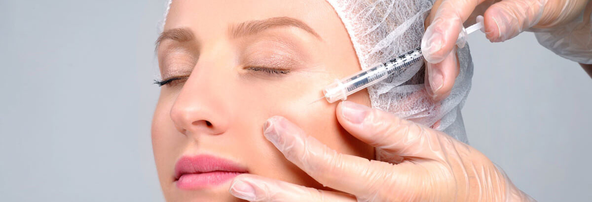 Cheek filler injections