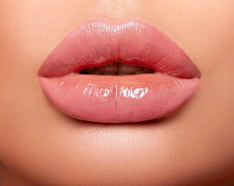 Filled Russian Lips