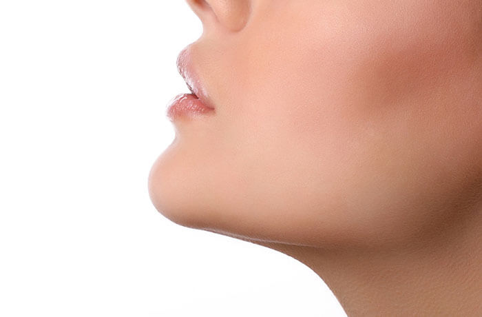 Kybella for jowls and cheeks