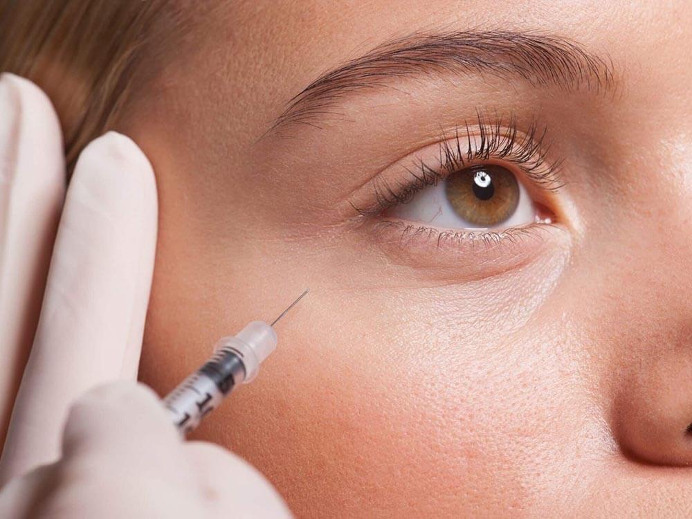 under eye filler injection