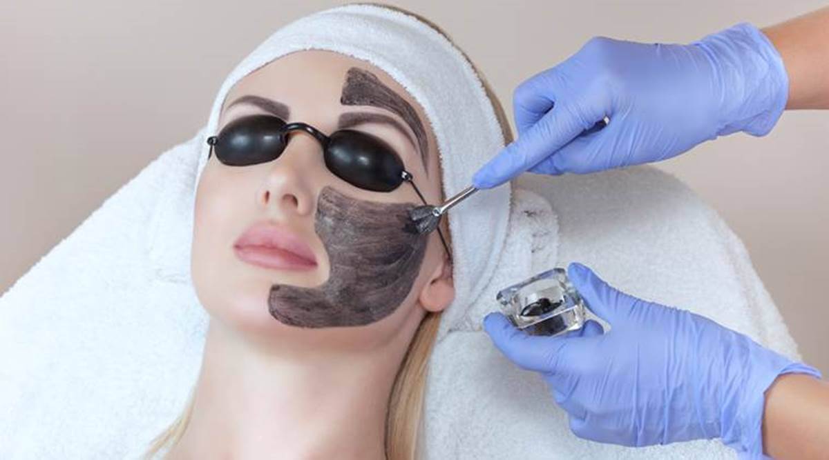 Carbon Laser Facial treatment