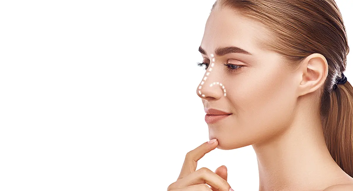 Nose Filler Rhinoplasty
